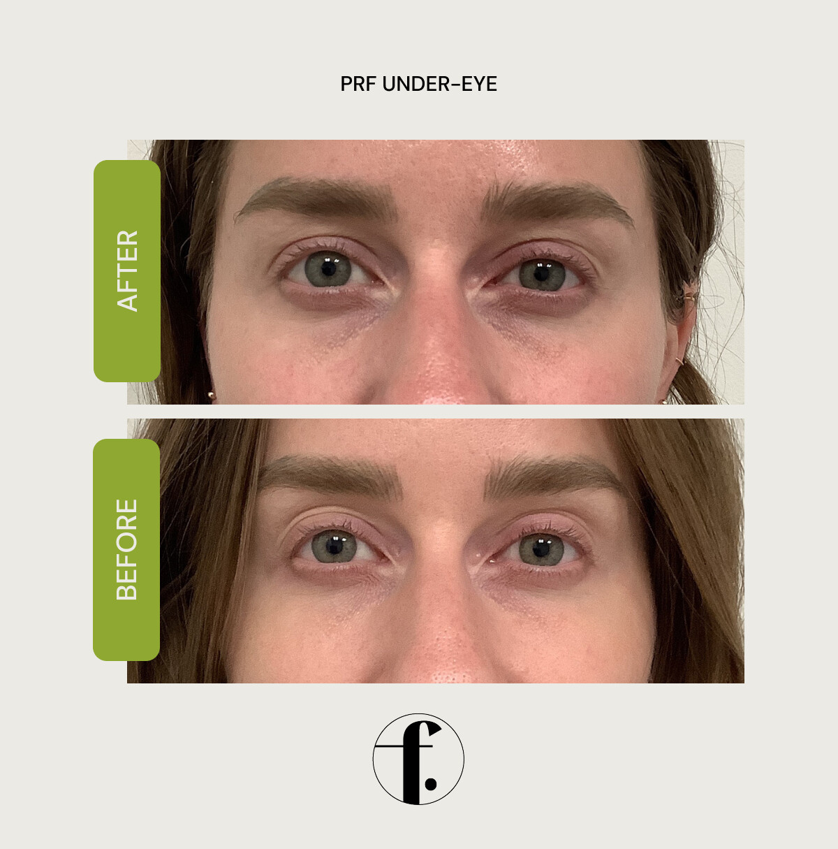 18-home-comparison
