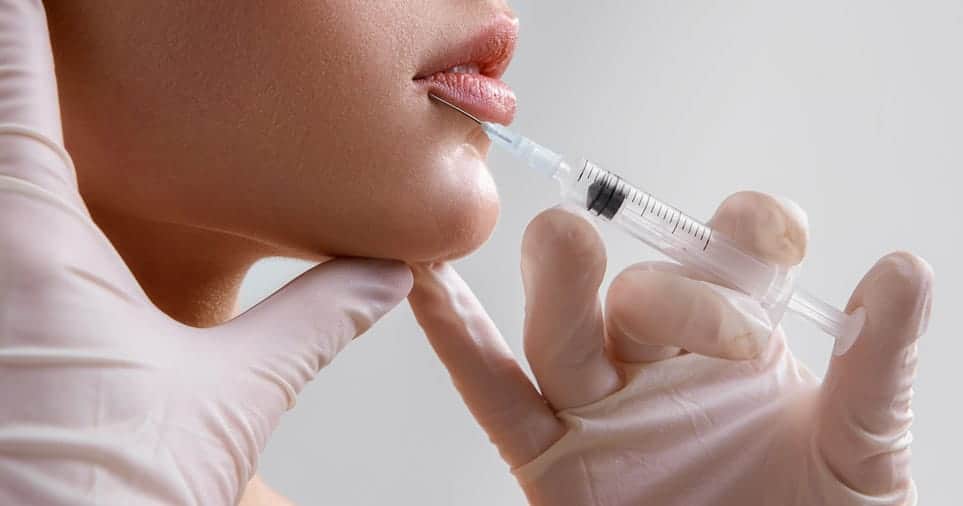 dermal fillers