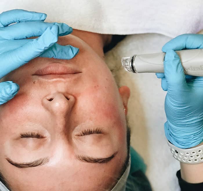 hydrafacial treatment on client