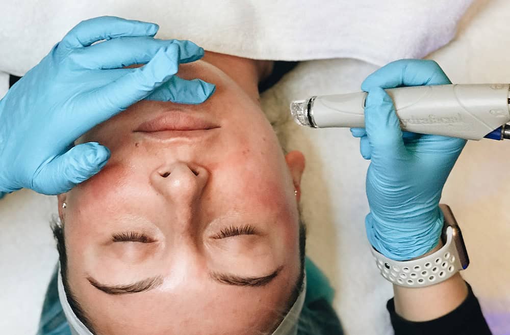 hydrafacial treatment on client