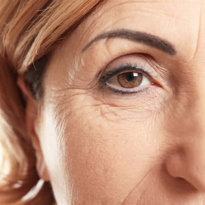 fine line eye wrinkles