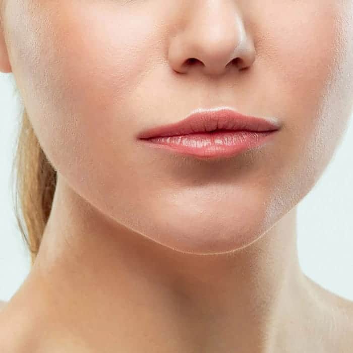 lip fillers