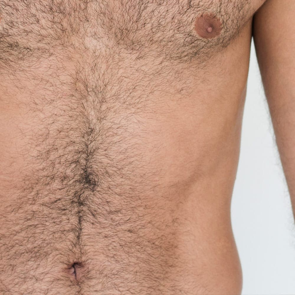 CoolSculpting for men