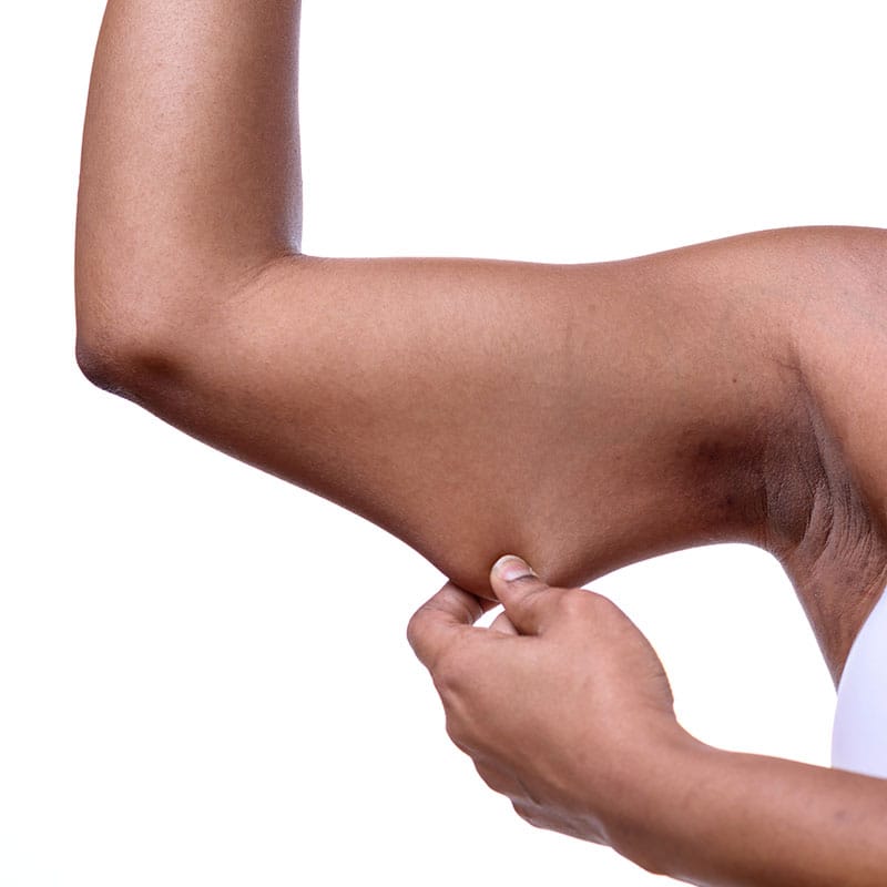 saggy skin treatment