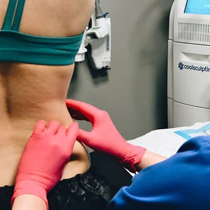 CoolSculpting on client's back