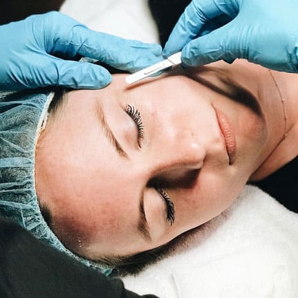 dermaplane service at facial aesthetics