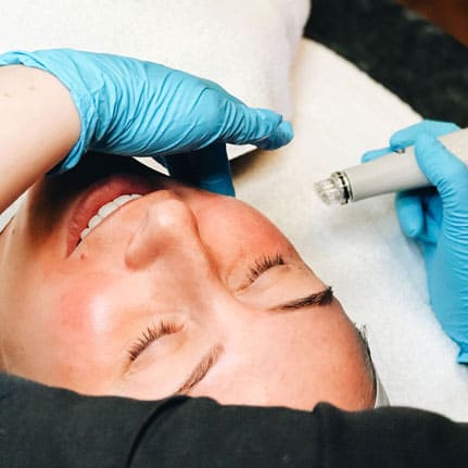 hydrafacial treatment on client