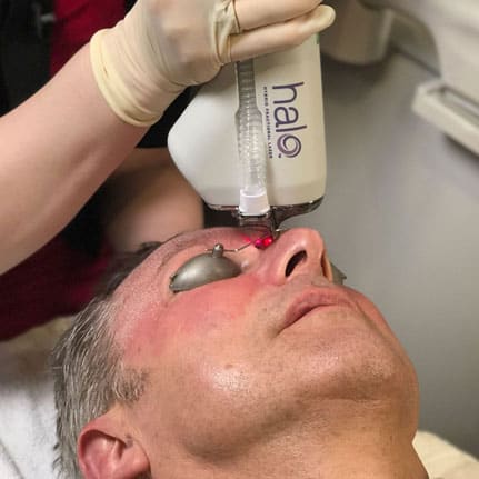 HALO treatment on male client