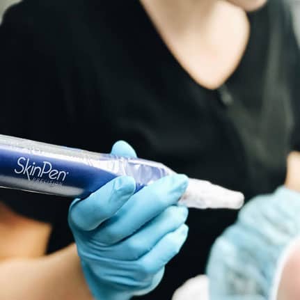 aesthetician holding skinpen