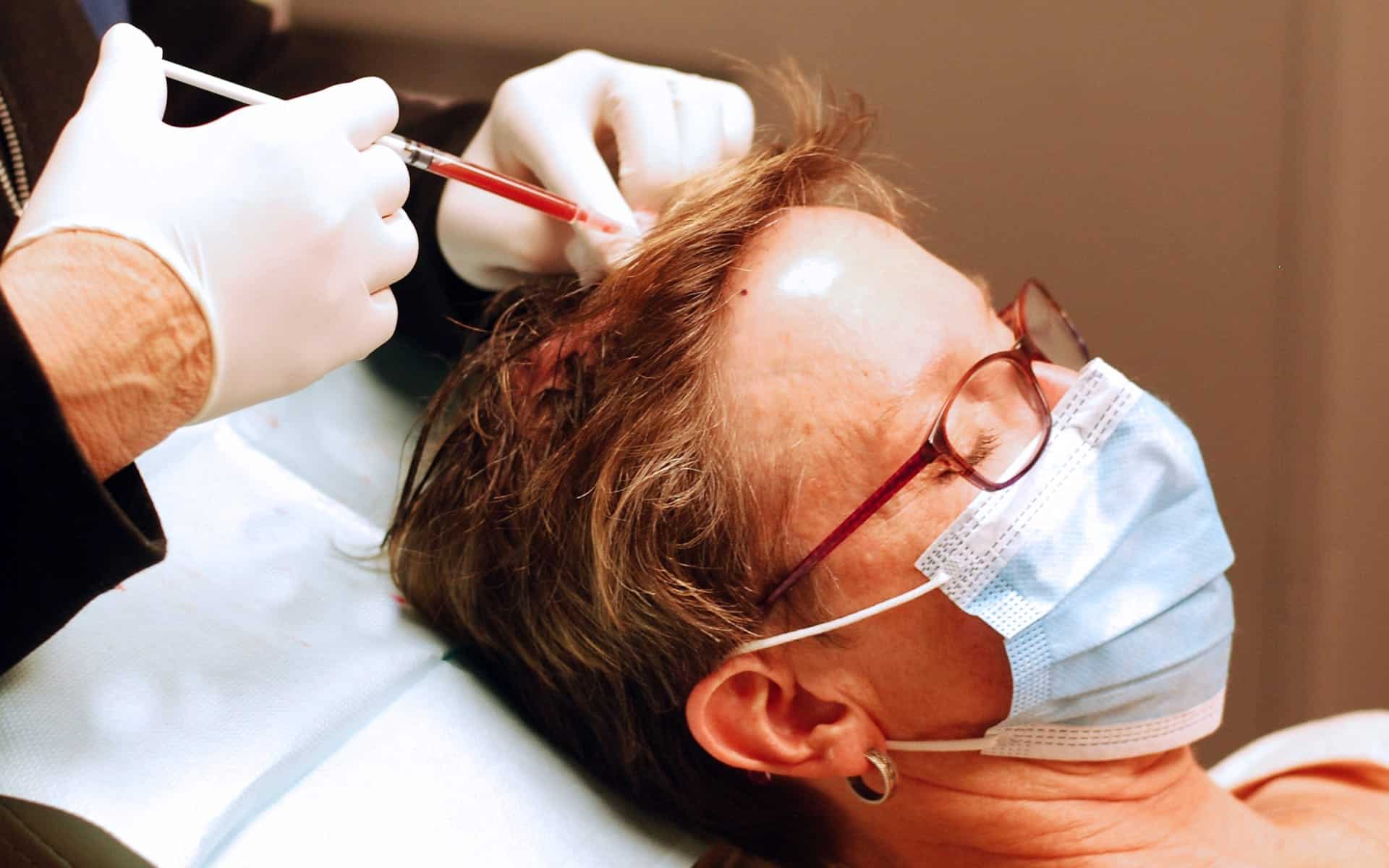 prp injection on client's head for hair loss