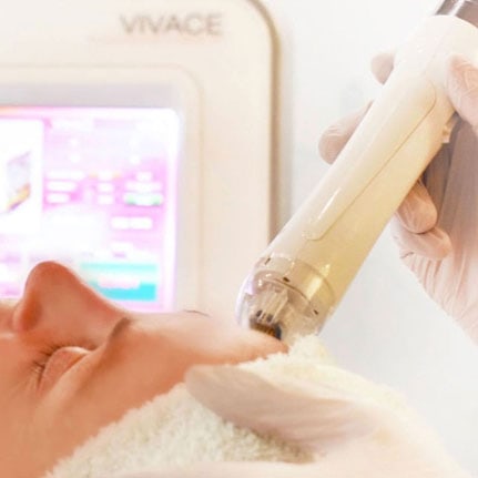 vivace treatment on client forehead