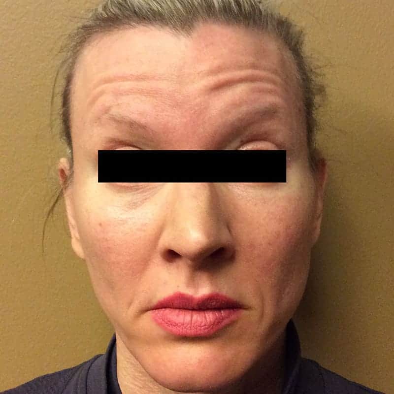 Liquid Refresh treatment before