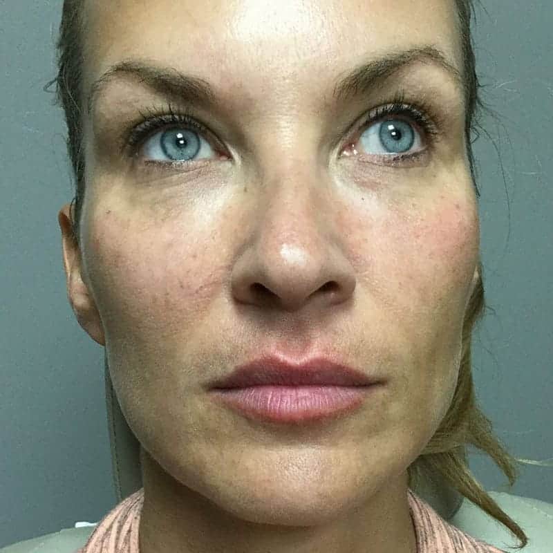 Liquid Refresh treatment after client result