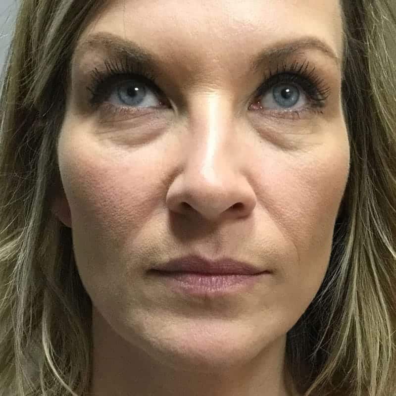 Liquid Refresh treatment before client image