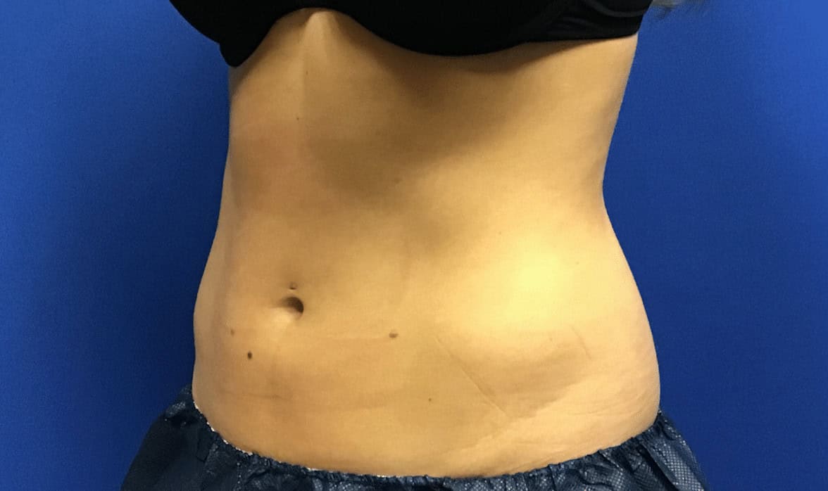 cool tone before and after