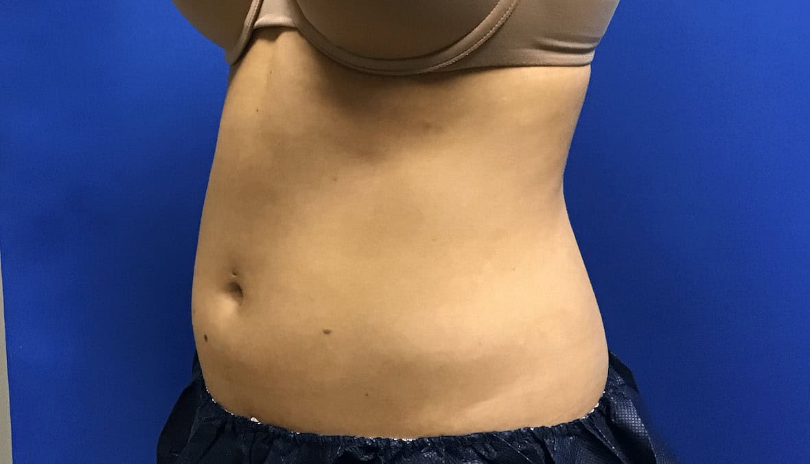 cool tone before and after