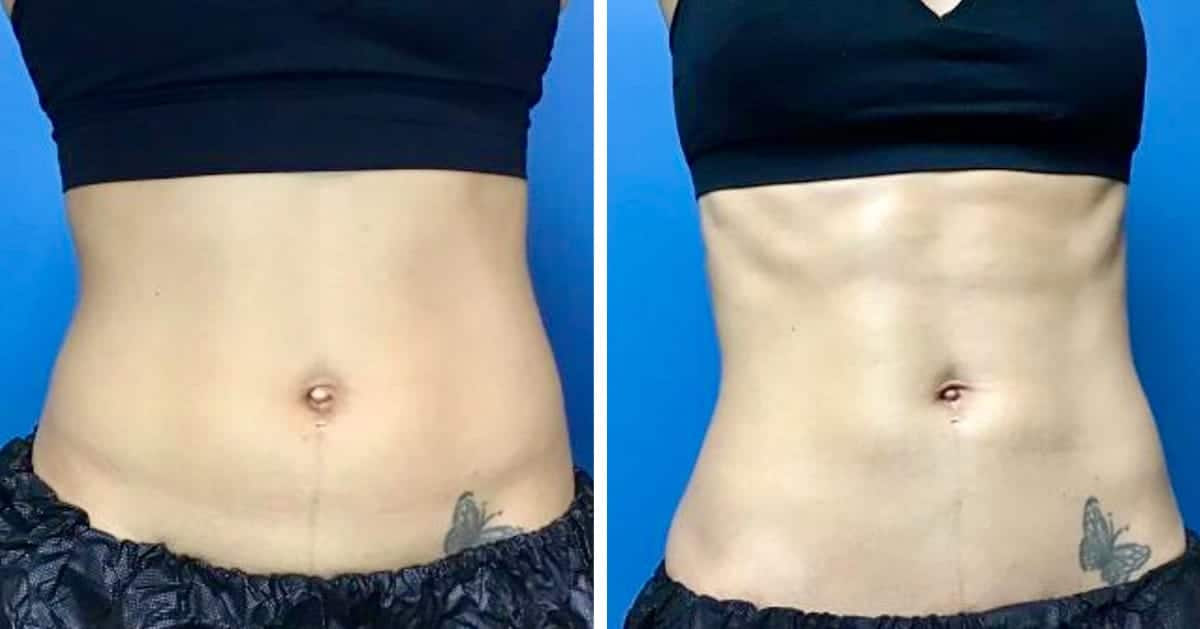 cool tone before and after