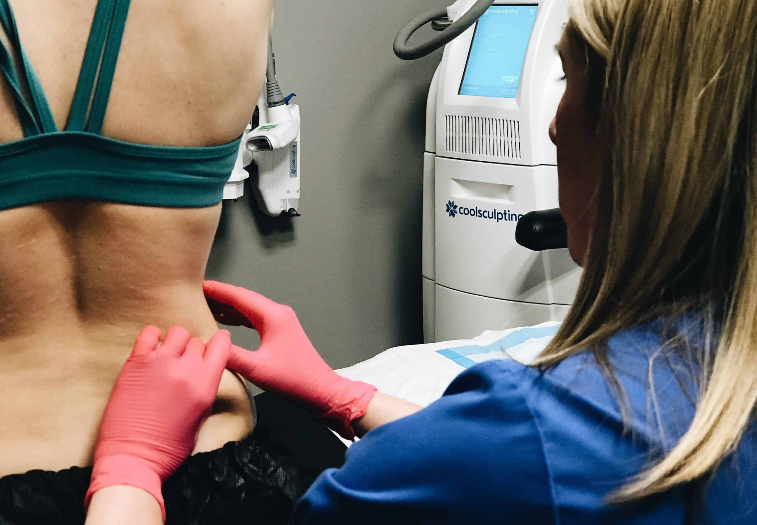 Coolsculpting on client's back