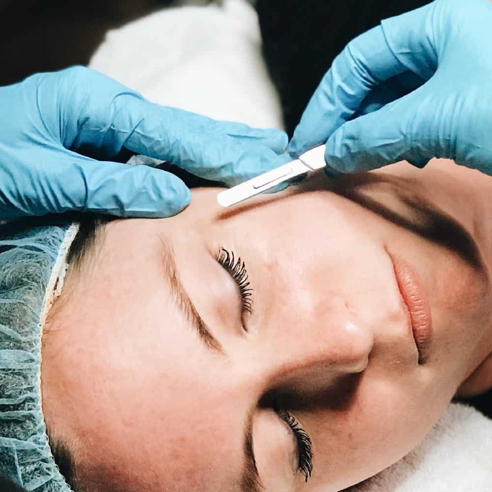 dermaplaning treatment