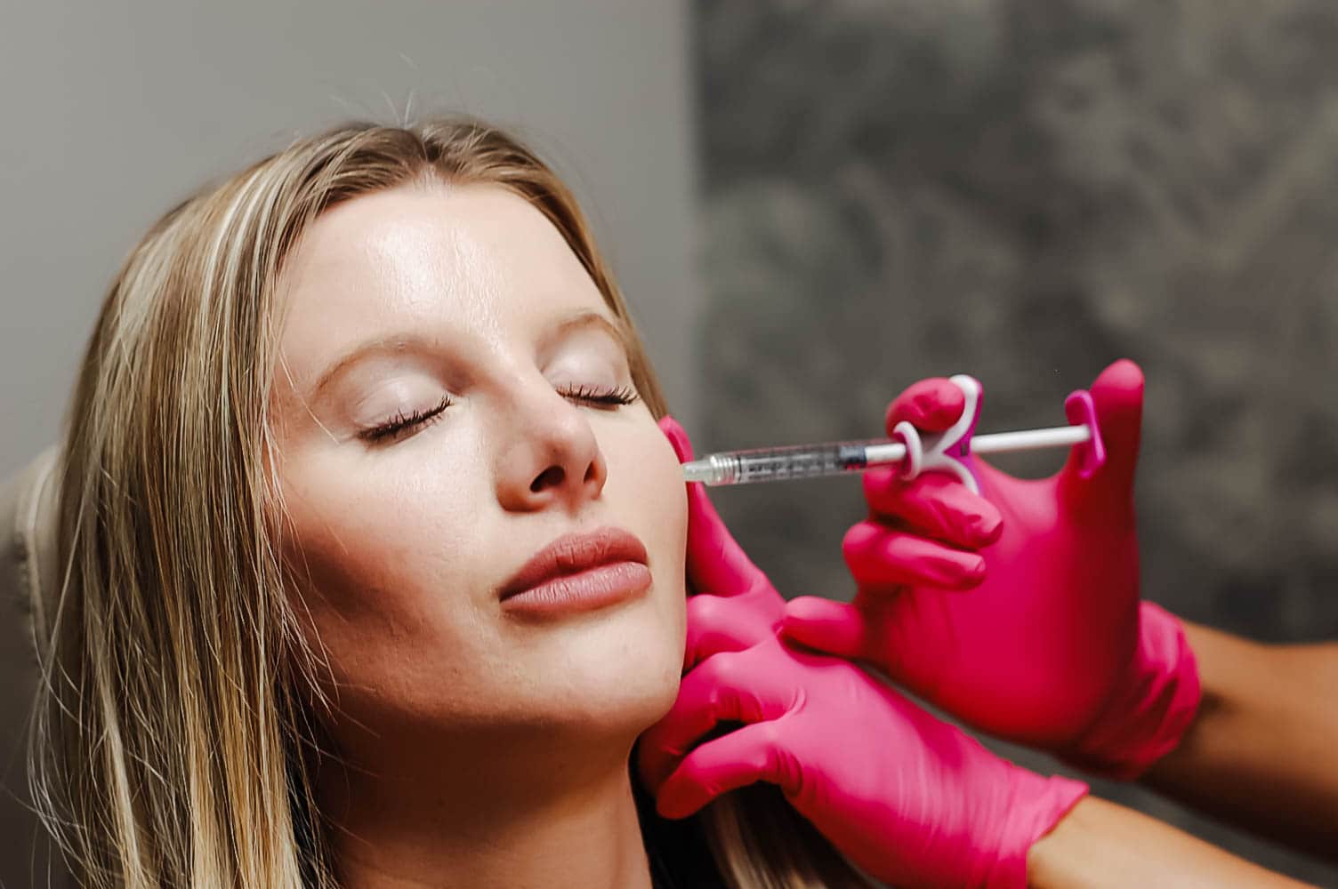 client getting cheek filler