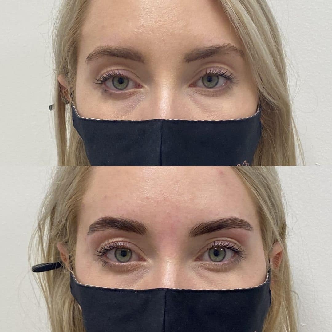 Before and After Eyes-Lamination Tint