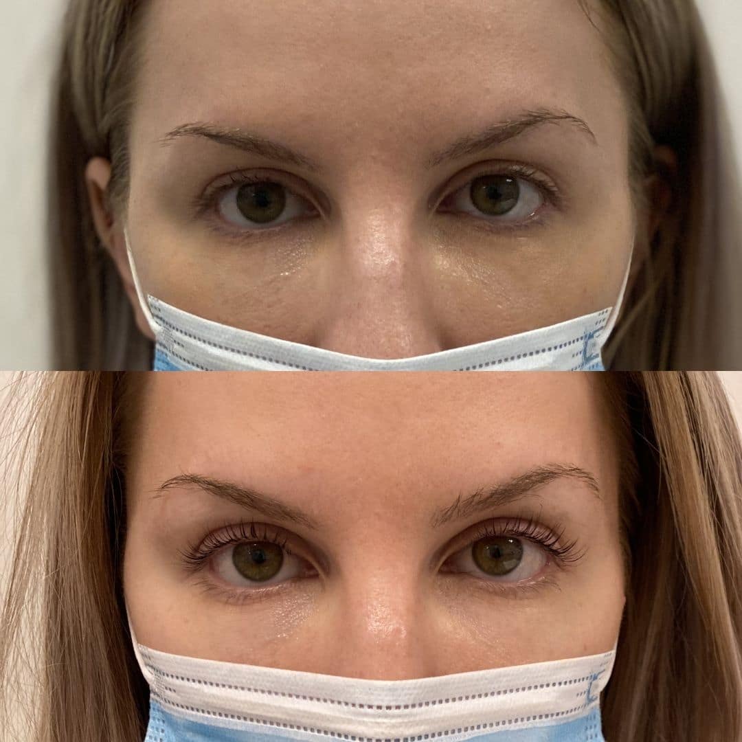 Before and After Eyes-Lash Lift Tint