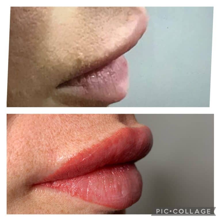 Lip Shading before and after