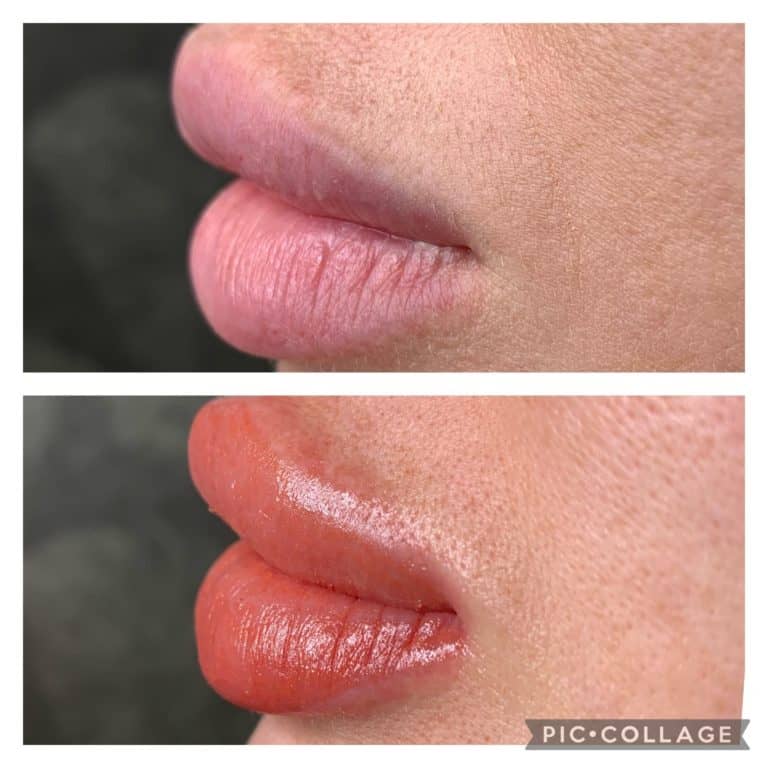Lip Shading before and after