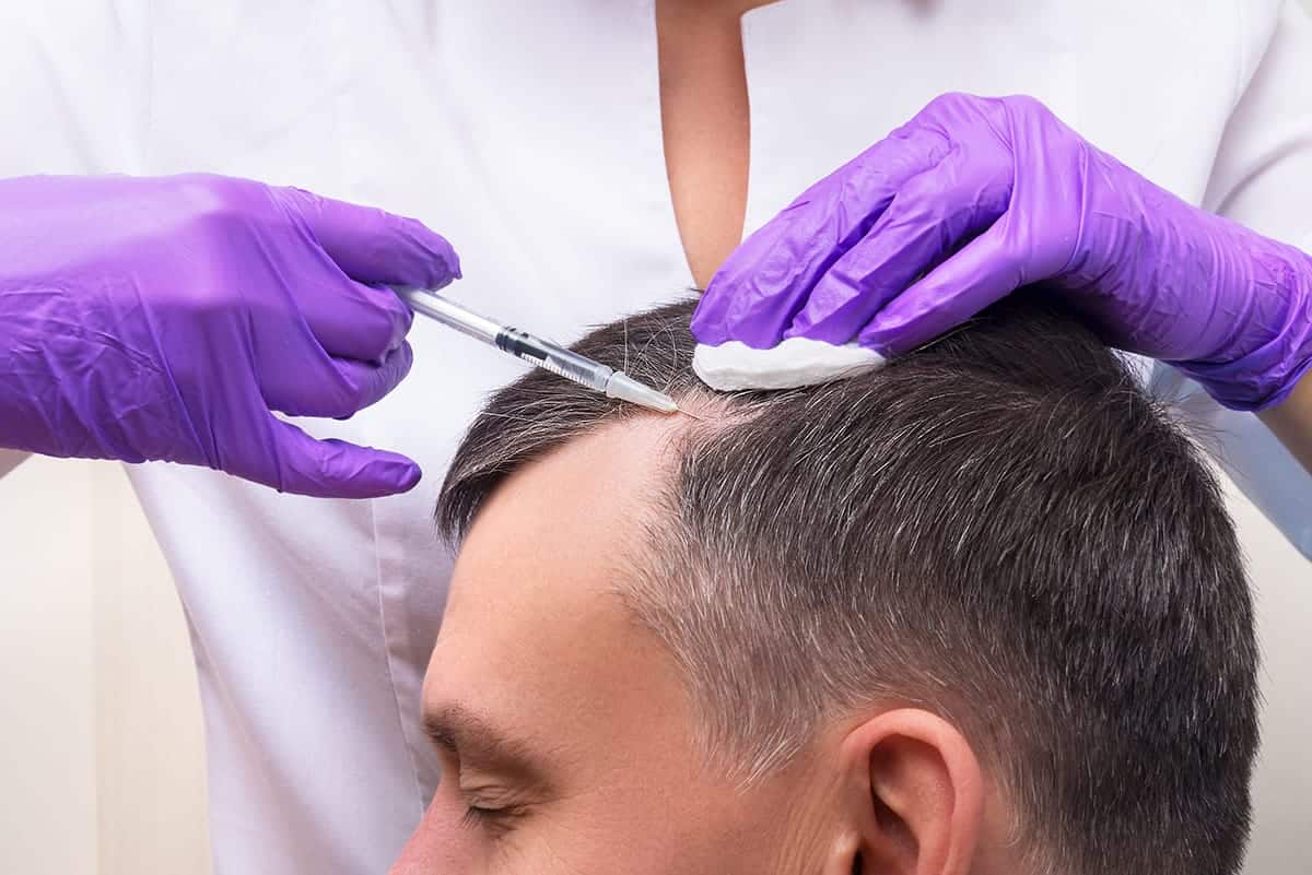 prp treatment on man's hair