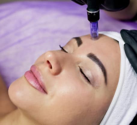 beautician-makes-injections-intoz-forehead-mesotherapy-with-microneedle
