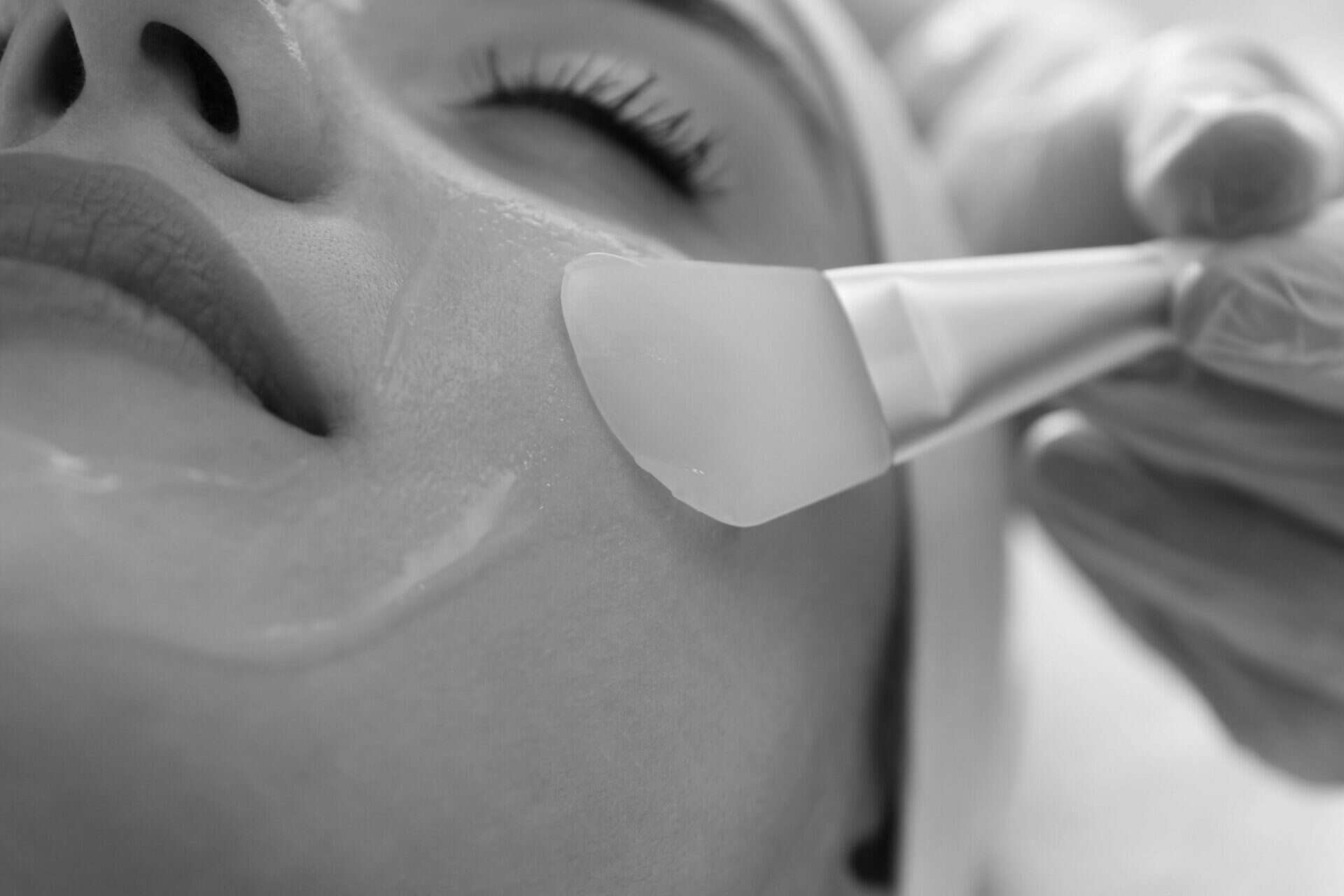 model getting a Chemical Peel