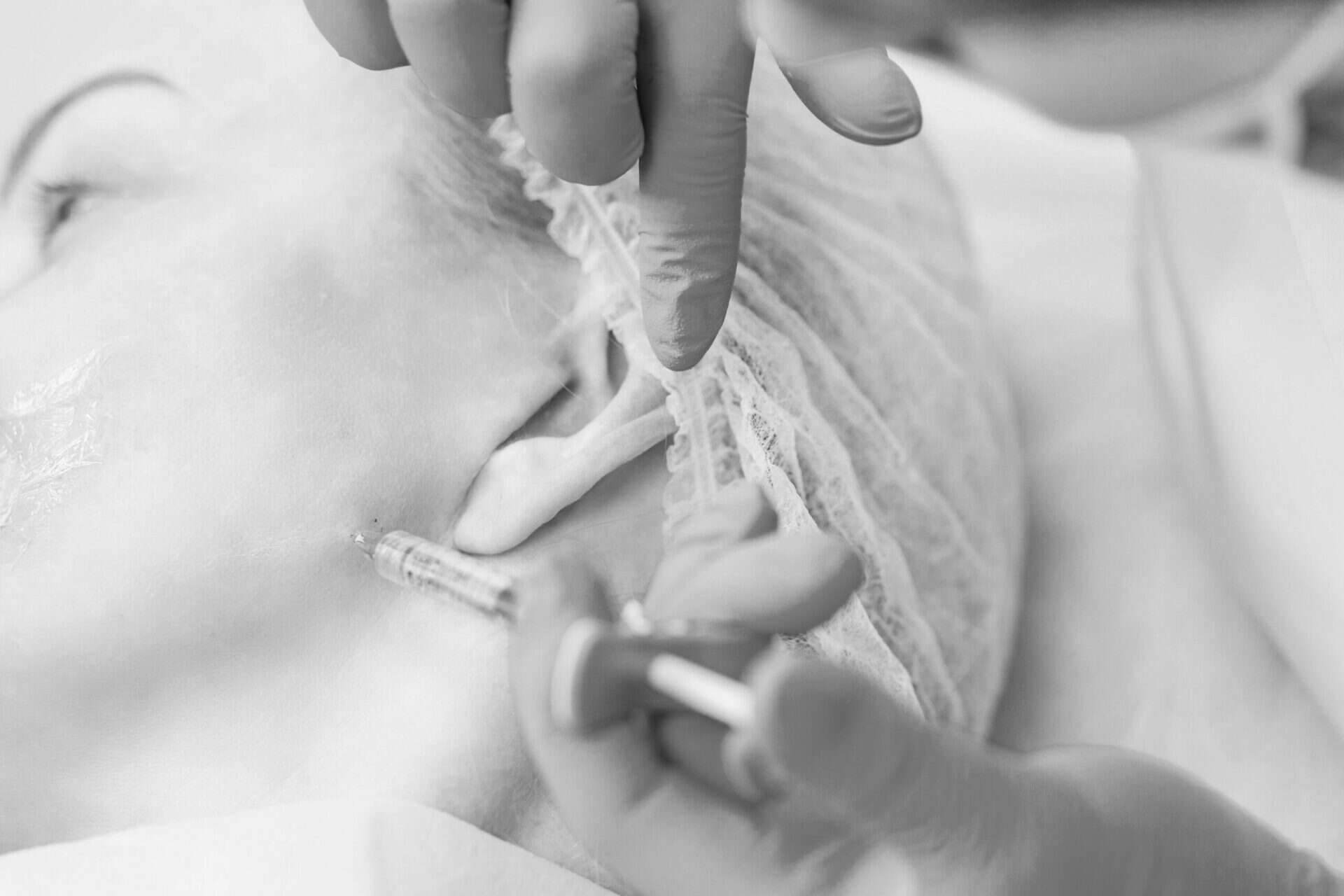 jaw slimming injection