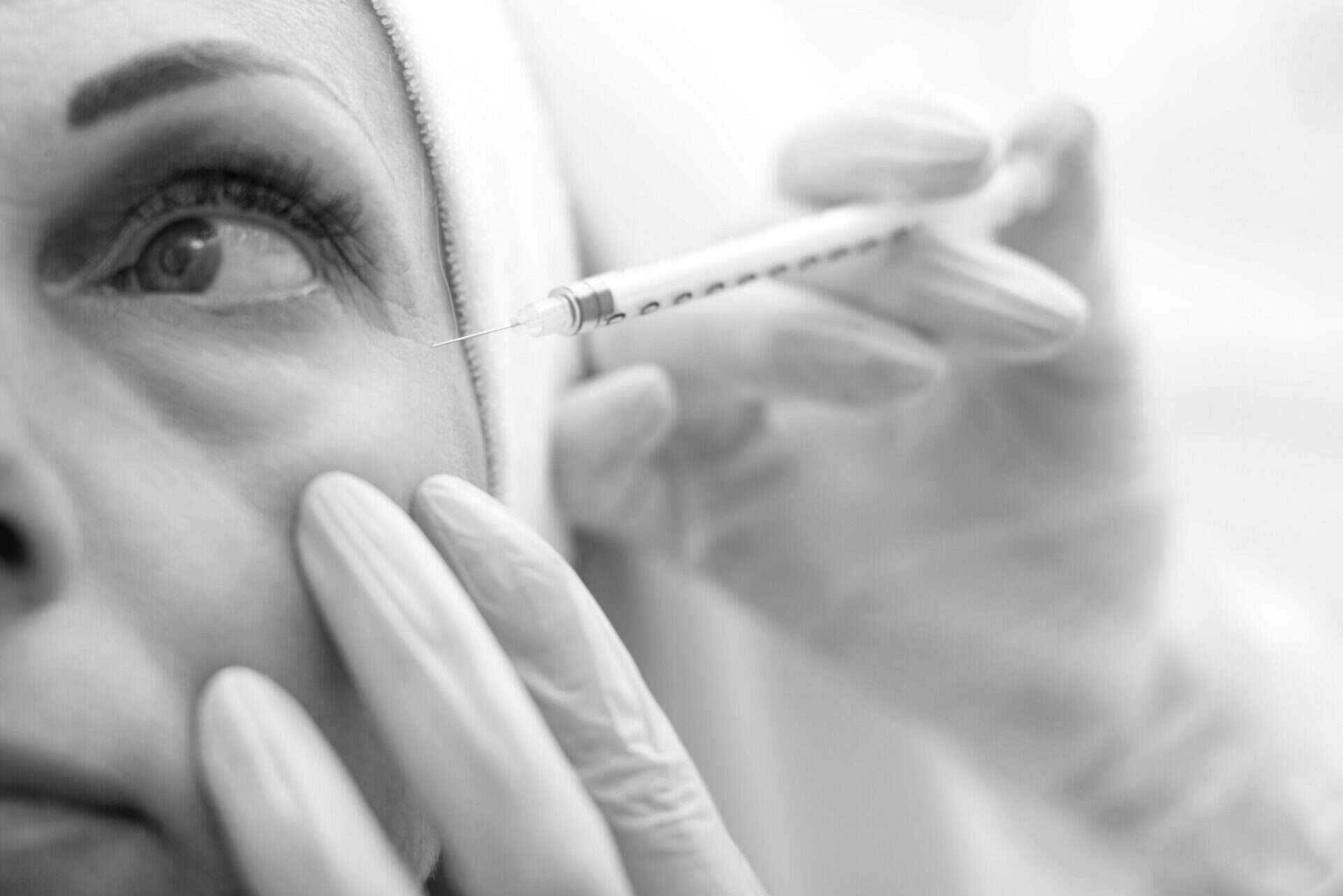 botox around eyes