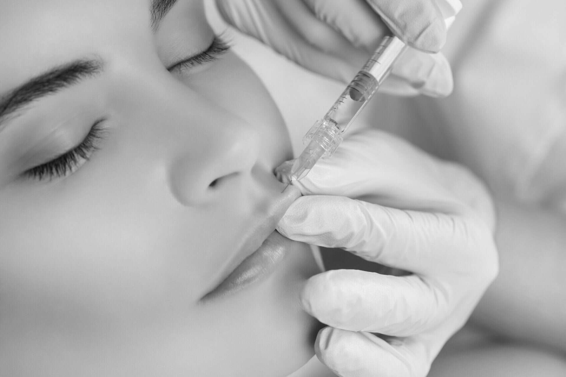 model getting botox lip flip