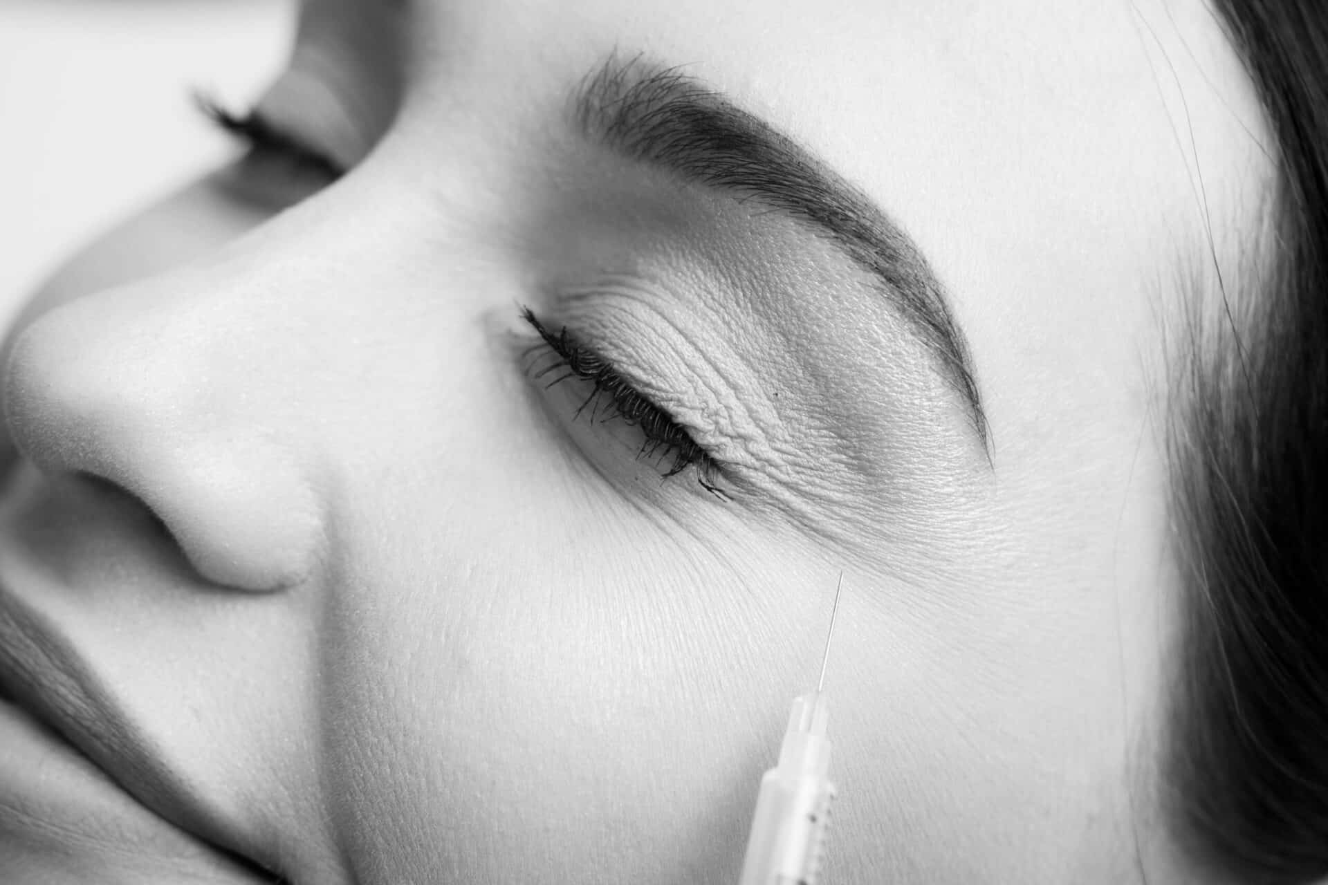 how to prepare for botox treatment