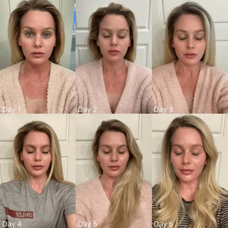 client before and after