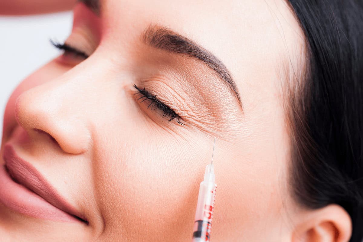 botox around eyes