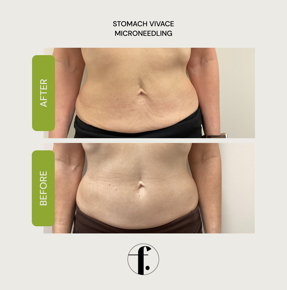 4-home-comparison