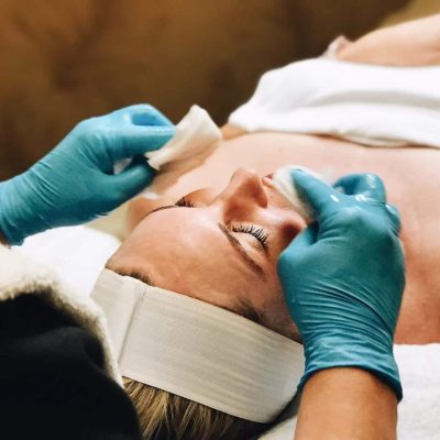 chemical peel facial on client