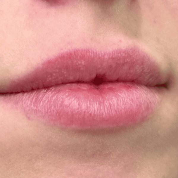 lip_02a