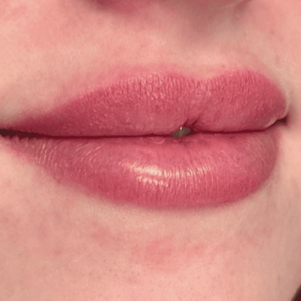 lip_02b