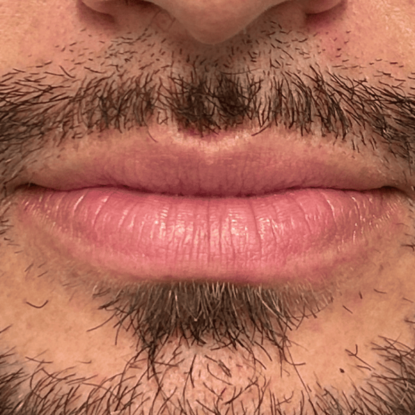 lip_03a