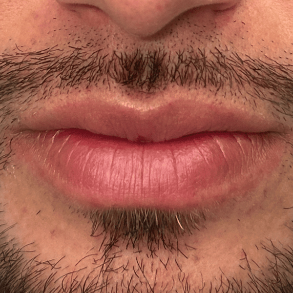 lip_03b