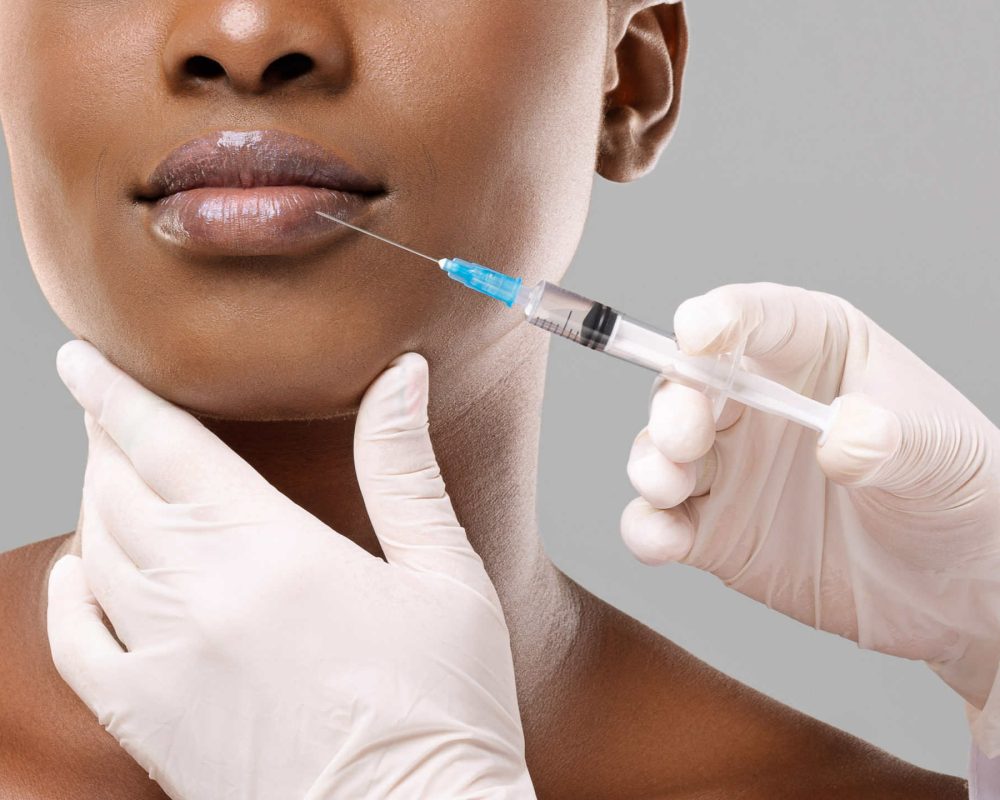 model getting lip filler