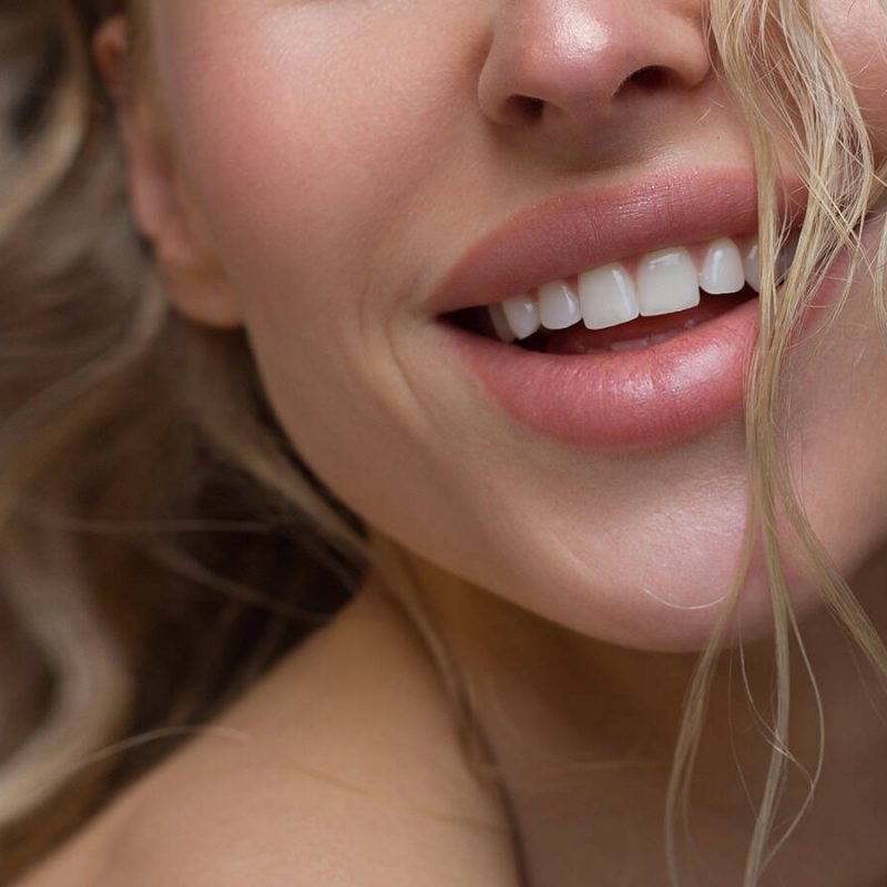 model smiling closeup of teeth