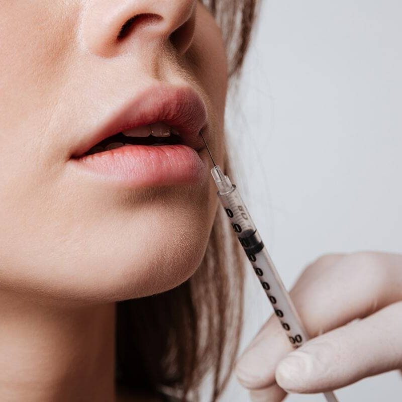 lip filler closeup