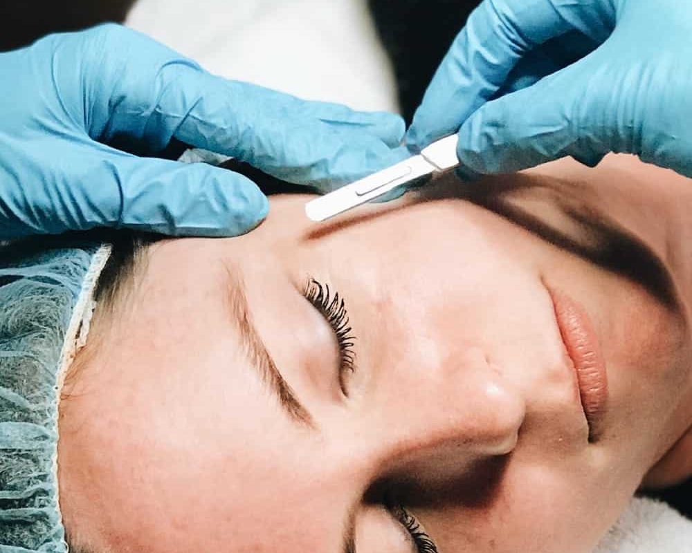dermaplaning treatment